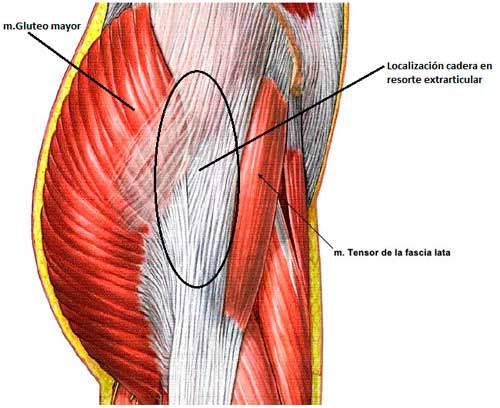 De las lesiones de cadera y pelvis, la cadera en resorte se diferencia por su sintomatología al flexionar la cadera, principalmente.