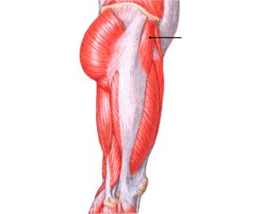 La cadera en resorte presenta un cuadro clínico que se caracteriza porque los pacientes notan un resalte o chasquido