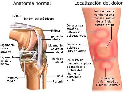 anatomía-y-dolor-en-la-rodilla