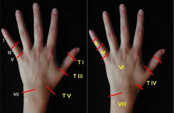 Tendones y articulaciones de los dedos de la mano