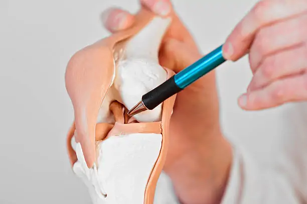 Prótesis de Rodilla con una Infección Testimonio