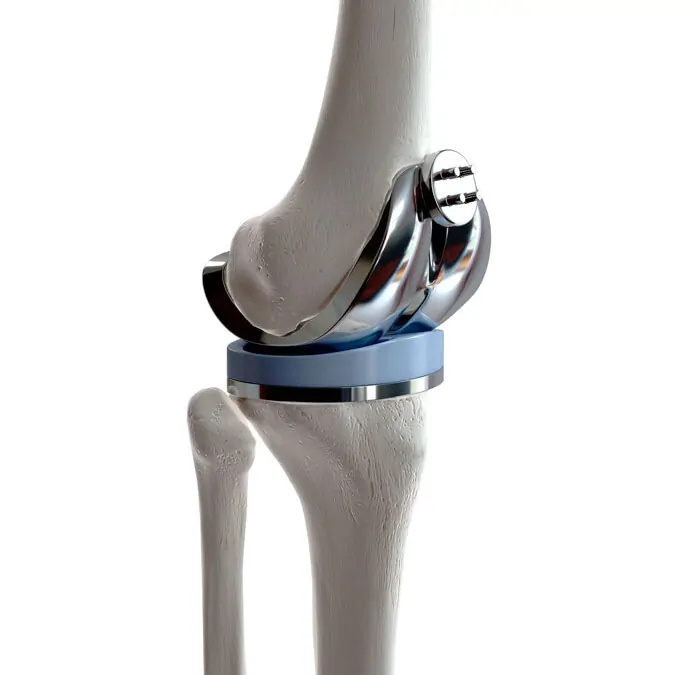Espaciadores de rodilla con antibiótico