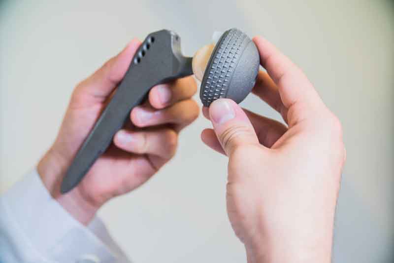 ¿Recambio total o parcial de prótesis de cadera? Dr. Villanueva