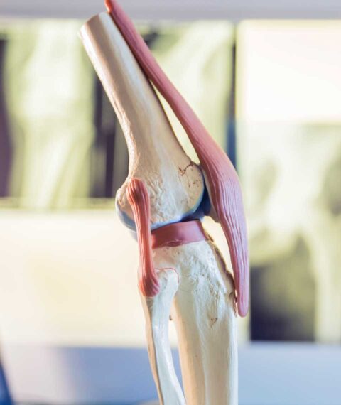 Tratamiento de la Osteopatía de pubis - pubalgia