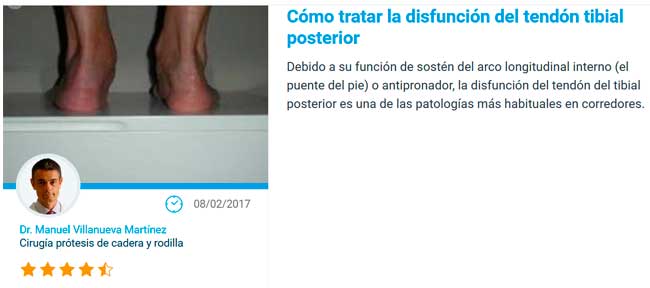 Disfunción del tendón tibial posterior 2
