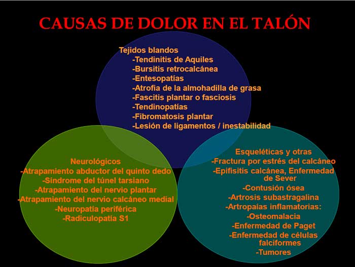 causas de dolor de talón en deportistas y corredores causas de dolor de talón en deportistas y corredores