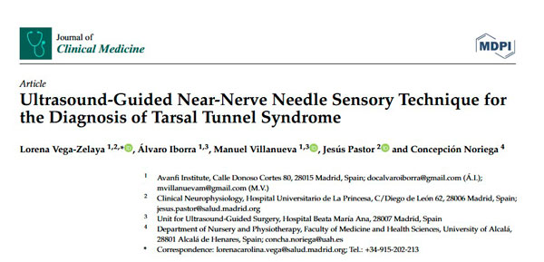 diagnóstico del síndrome del túnel del tarso. Ultrasound-Guided Near-Nerve Needle Sensory Technique for the Diagnosis of Tarsal Tunnel Syndrome