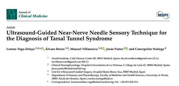diagnóstico del síndrome del túnel del tarso. Ultrasound-Guided Near-Nerve Needle Sensory Technique for the Diagnosis of Tarsal Tunnel Syndrome