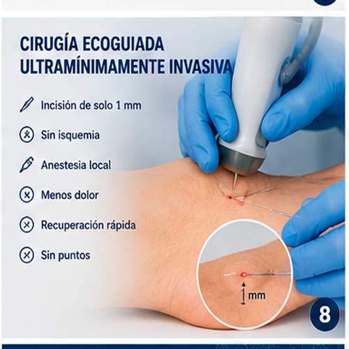 08 cirugia ecoguiada ultraminimamente invasiva