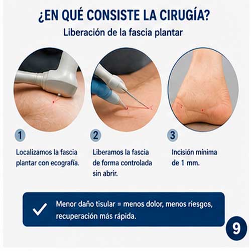 09 en que consiste la cirugia