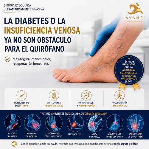 11 las ventasjas de la cirugia ecoguiada en casos de insuficiencia venosa o dibabetes