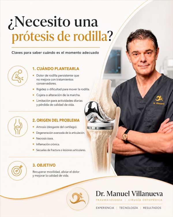 Cómo se si necesito una prótesis de rodilla