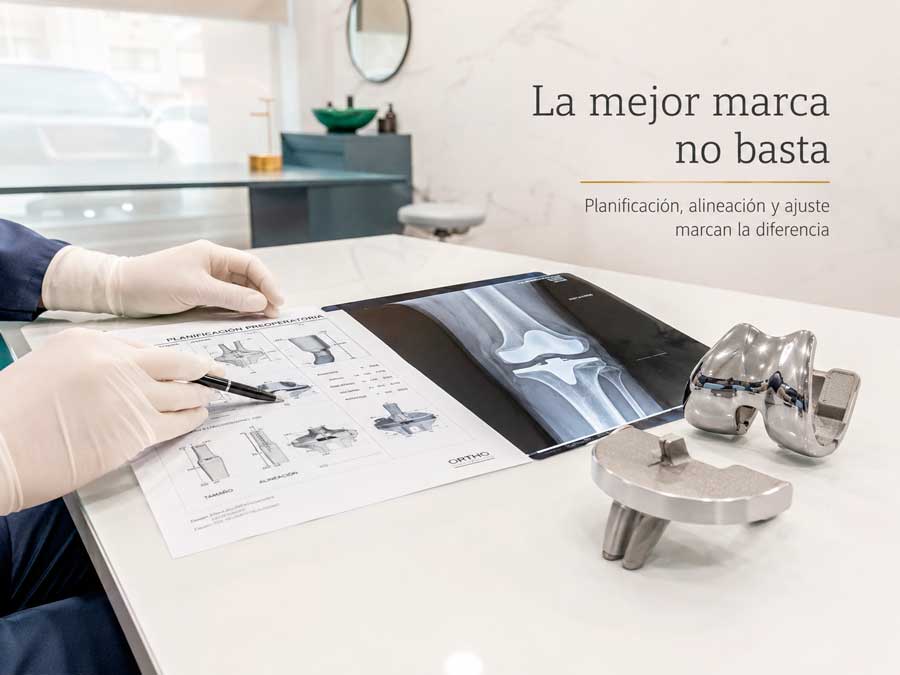Cuál es la mejor prótesis de rodilla