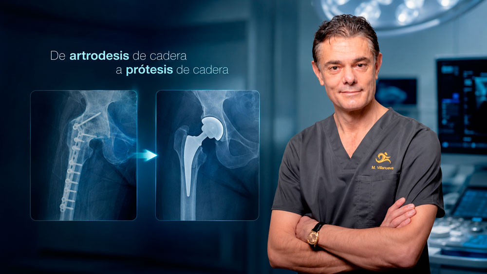 Dr. Villanueva, especialista en cirugía de desartrodesis de cadera compleja