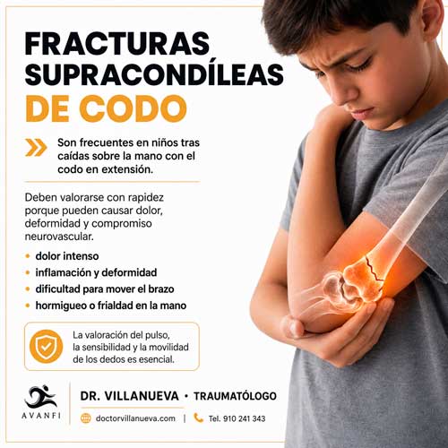 Clasificación: fracturas supracondíleas de codo sin desplazar y desplazadas