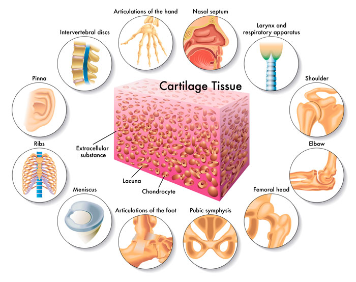 Lesiones del cartílago de la rodilla